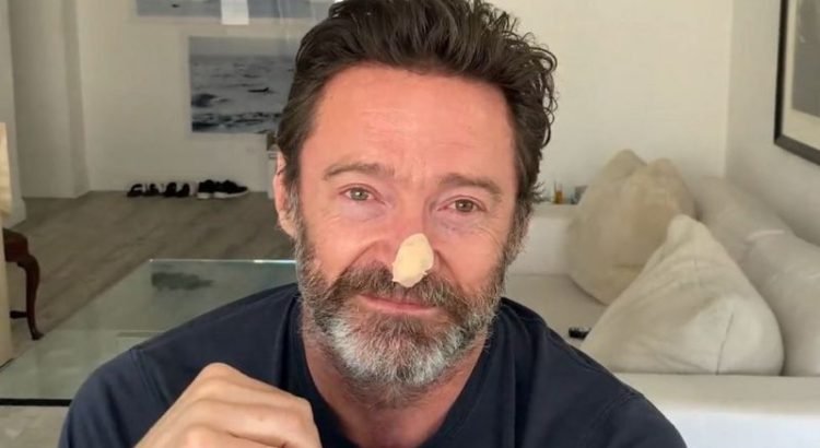 Hugh Jackman se sometió a otra biopsia y alerta sobre el cáncer de piel